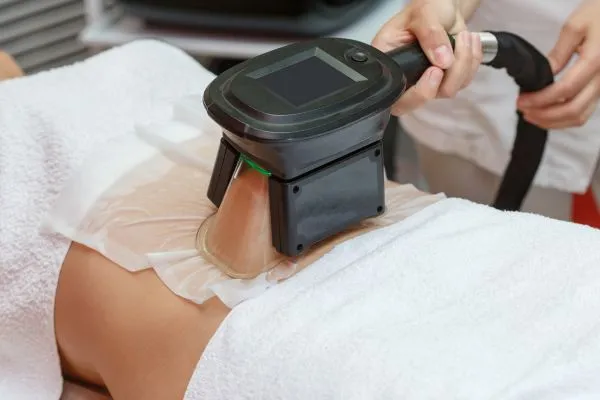 Image of person having fat freezing treatment to help weight gain Swindon