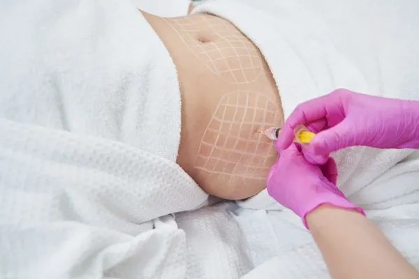 image of fat dissolving injections on love handles to help combat weight gain Swindon