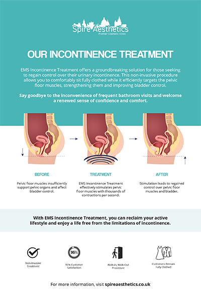 image to show how EMS treatment works for female urinary incontinence Swindon