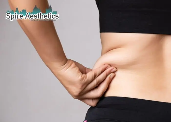 Image of woman pinching fat on their hips Swindon. Fat Freezing treatment