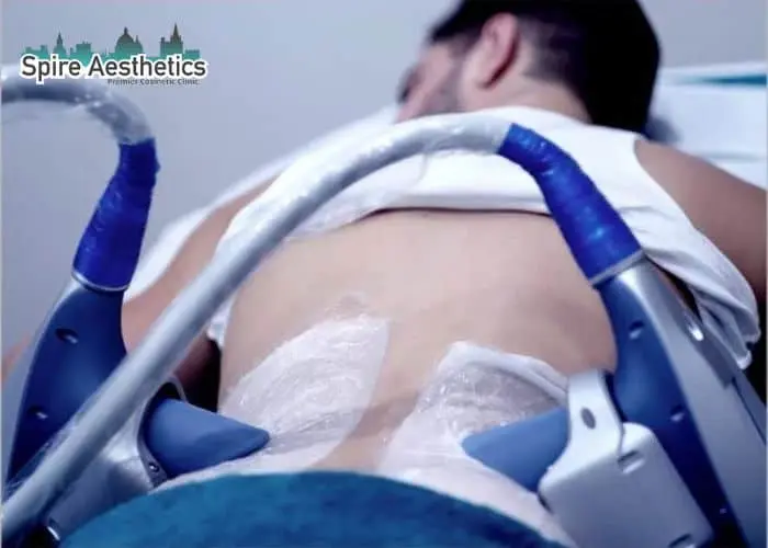 Man having fat freezing treatment done on love handles before a competitions Swindon to create a sculpted look.