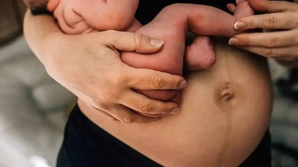 Why Is My Stomach Still Big After Pregnancy Swindon?