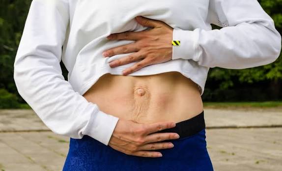 When Could Diastasis Recti Be the Missing Piece of the Puzzle Swindon?